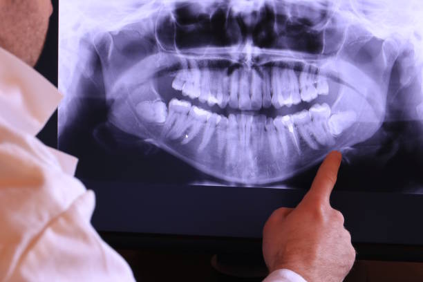 Best Emergency Denture Repair in Philadelphia, PA