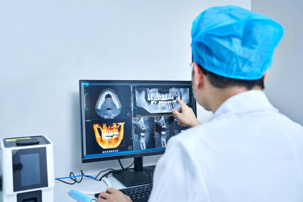 Best Knocked-Out Tooth (Avulsed Tooth) Treatment in Philadelphia, PA